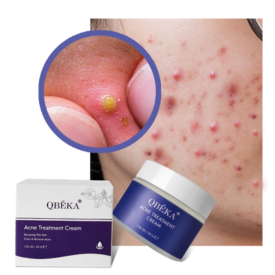 Gepersonaliseerd logo Puistjes Creme Verlichting Whitening met hyaluronzuur ingrediënt