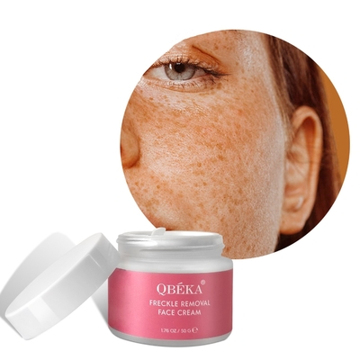 Retinol gezichtscrème voor sproetenverwijdering Op maat gemaakte geur en private label aangeboden