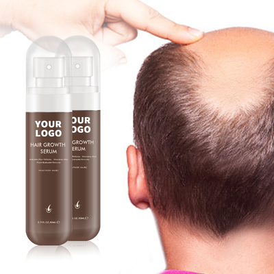 100% Pure Plant Extract Formule Scalp Serum Moisturizer voor Sterke en Gezonde Scalp