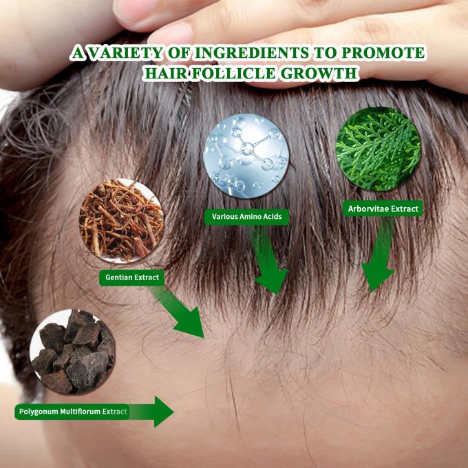 Biologisch haargroei serum Extern gebruik Haargroei behandeling Anti haarverlies Spray 80 ml 0