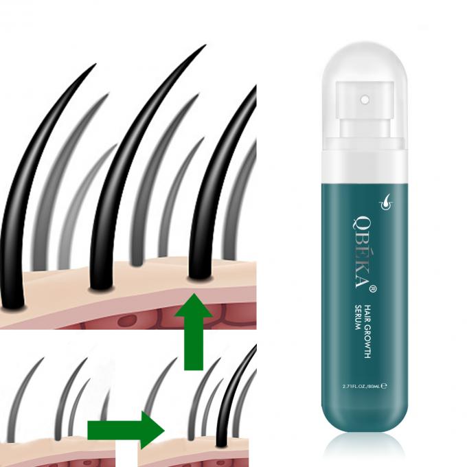 80 ml haargroei-olie Private Label Product Professionele QC Team Anti Hair Loss Serum 0