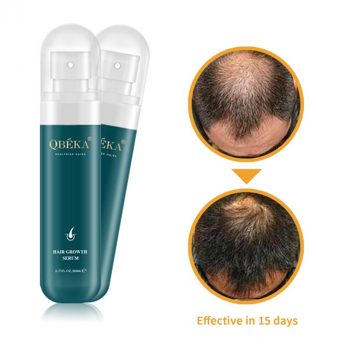 80 ml haargroei-olie Private Label Product Professionele QC Team Anti Hair Loss Serum 1