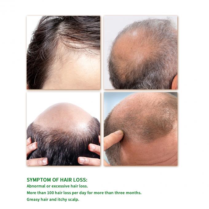 OEM/ODM kruidengroei-serum voor haarverliesbehandeling en textuurverbetering 1