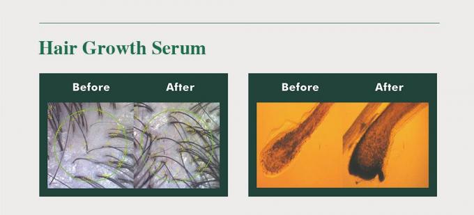 Herbal haarversterker voor mannen Voorkomen haarverlies Hergroeien haar Verbeteren volume 3 maand aanbod 2