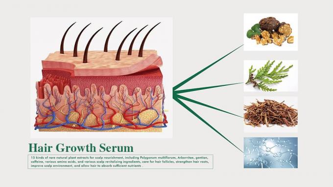 Herbal haarversterker voor mannen Voorkomen haarverlies Hergroeien haar Verbeteren volume 3 maand aanbod 1