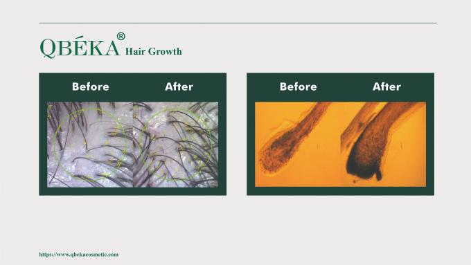GMPC Standard Haarverlies Preventie Shampoo voor haarverlies en dunner worden behandeling 80m 11