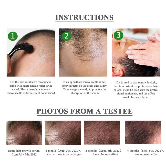 Kruiden 7-15 Dagen Haargroei Serum Herstel het volume en de glans van uw haar moeiteloos 3