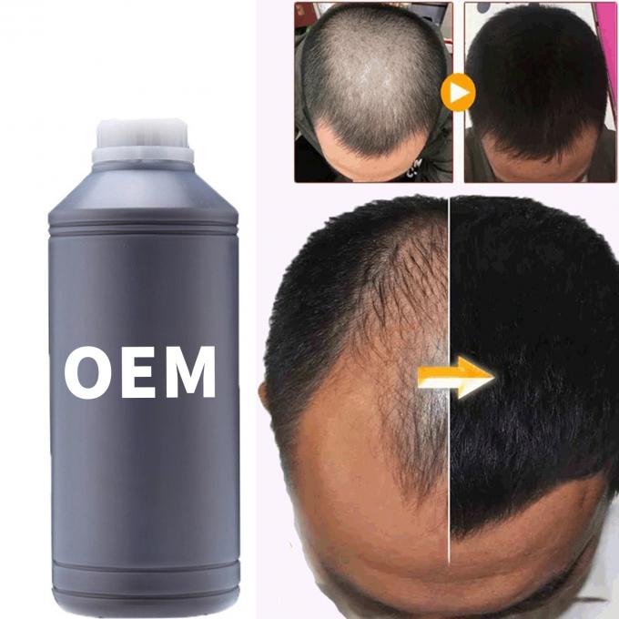 36 maanden houdbaarheidsduur Haargroei Booster Olie Serum Voor Alle Haartypen Haarverlies Zorg 3