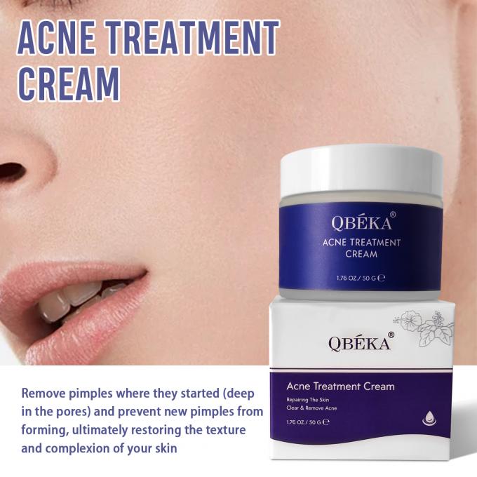 Verlichting en herstel van acne littekens Natuurlijke organische acne behandeling crème Hoeveelheid 1000 2