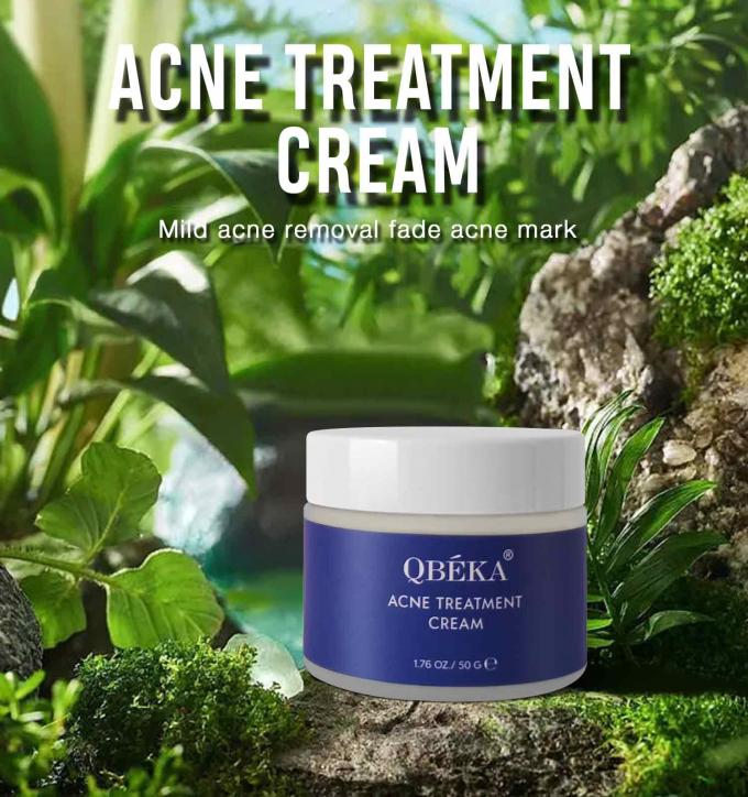 Verlichting en herstel van acne littekens Natuurlijke organische acne behandeling crème Hoeveelheid 1000 0