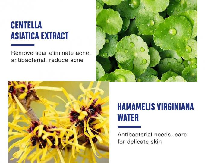 Verlichting en herstel van acne littekens Natuurlijke organische acne behandeling crème Hoeveelheid 1000 12