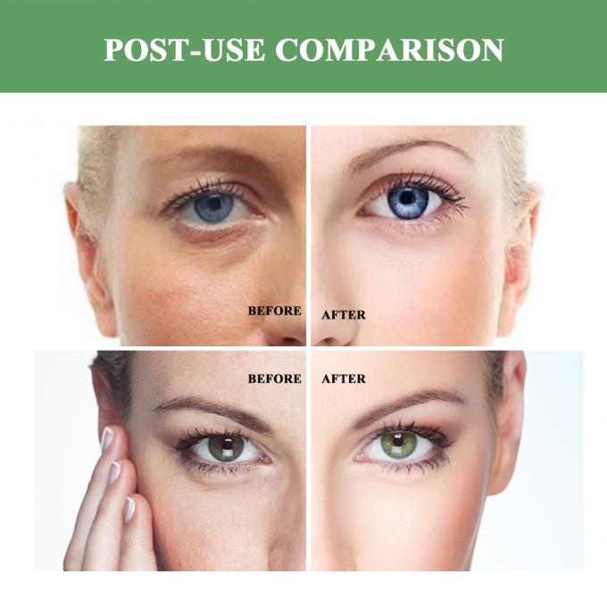 Regelmatige grootte Anti-aging moisturizer biologische natuurlijke rimpelopheffende crème voor volwassenen 7