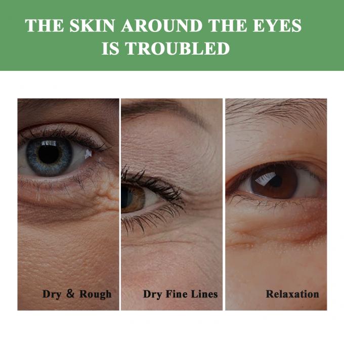 Anti-rimpel oogcrème voor donkere kringen en zwelling 20 ml volume oogzak verwijdering crème 8