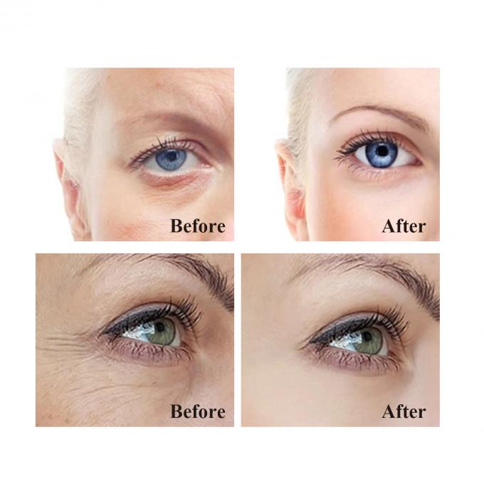 Anti-rimpel oogcrème voor donkere kringen en zwelling 20 ml volume oogzak verwijdering crème 9