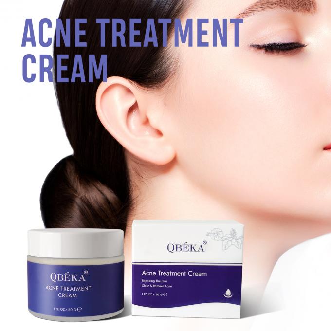 Effectieve groene thee acne behandeling crème voor vrouwen in bulk 0