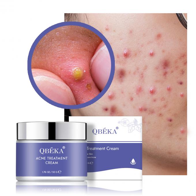 Home Vitamine C Olie van de theeboom huidverzorging voor het verlichten van acne en het vervagen van littekens 0