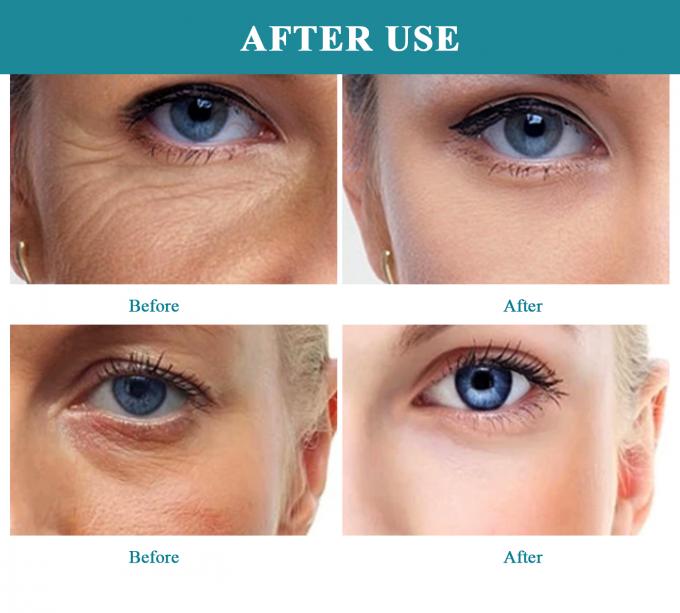 EYE 30 ml verhelderend hyaluronzuur multi-effect serum voor anti-aging huidverzorging in de buurt van mij 6
