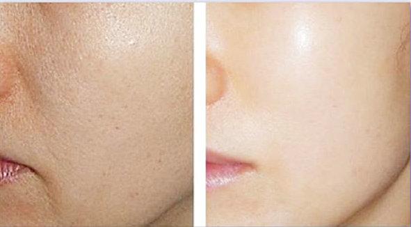 Collageen Overnight Wrinkle Free Face Sheet 40g Jumbo Size 1000boxen Hoge beschikbaarheid 4