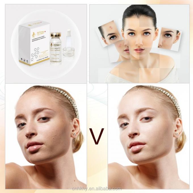 Verwijder acne littekens met QBEKA Happy Cosmetics Levorotatory VC Original Liquid Bio Serum 0
